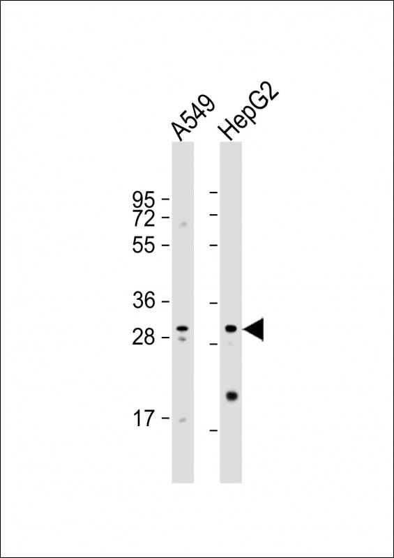 WB - MRPL28 Antibody (N-term) AP19152a